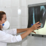 Tuberculose: Amazonas lidera incidência no Brasil, seguido por Roraima e Rio de Janeiro