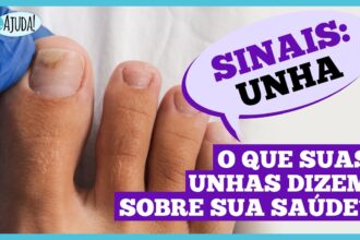 Unhas fracas podem indicar problemas de saúde