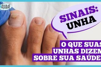 Dr. Ajuda: Unhas fracas podem indicar problemas de saúde