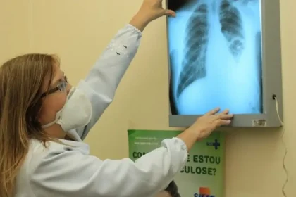 Ministério da Saúde repassa R$ 100 milhões para combate à tuberculose em 913 municípios