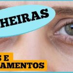 Olheiras: por que aparecem e o que fazer