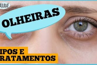 Olheiras: por que aparecem e o que fazer