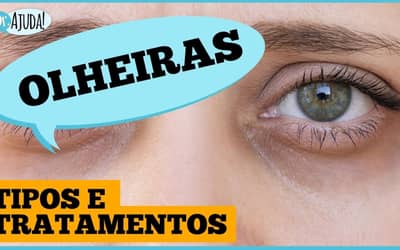 Olheiras: por que aparecem e o que fazer