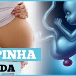 O que é e como prevenir a mielomeningocele?