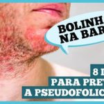 Pseudofoliculite: saiba como prevenir