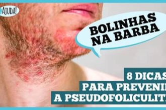 Pseudofoliculite: saiba como prevenir