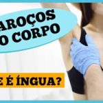 Íngua no pescoço, axila ou virilha? Entenda o que pode ser