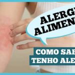 Alergia alimentar: como reconhecer os sinais e quando procurar ajuda